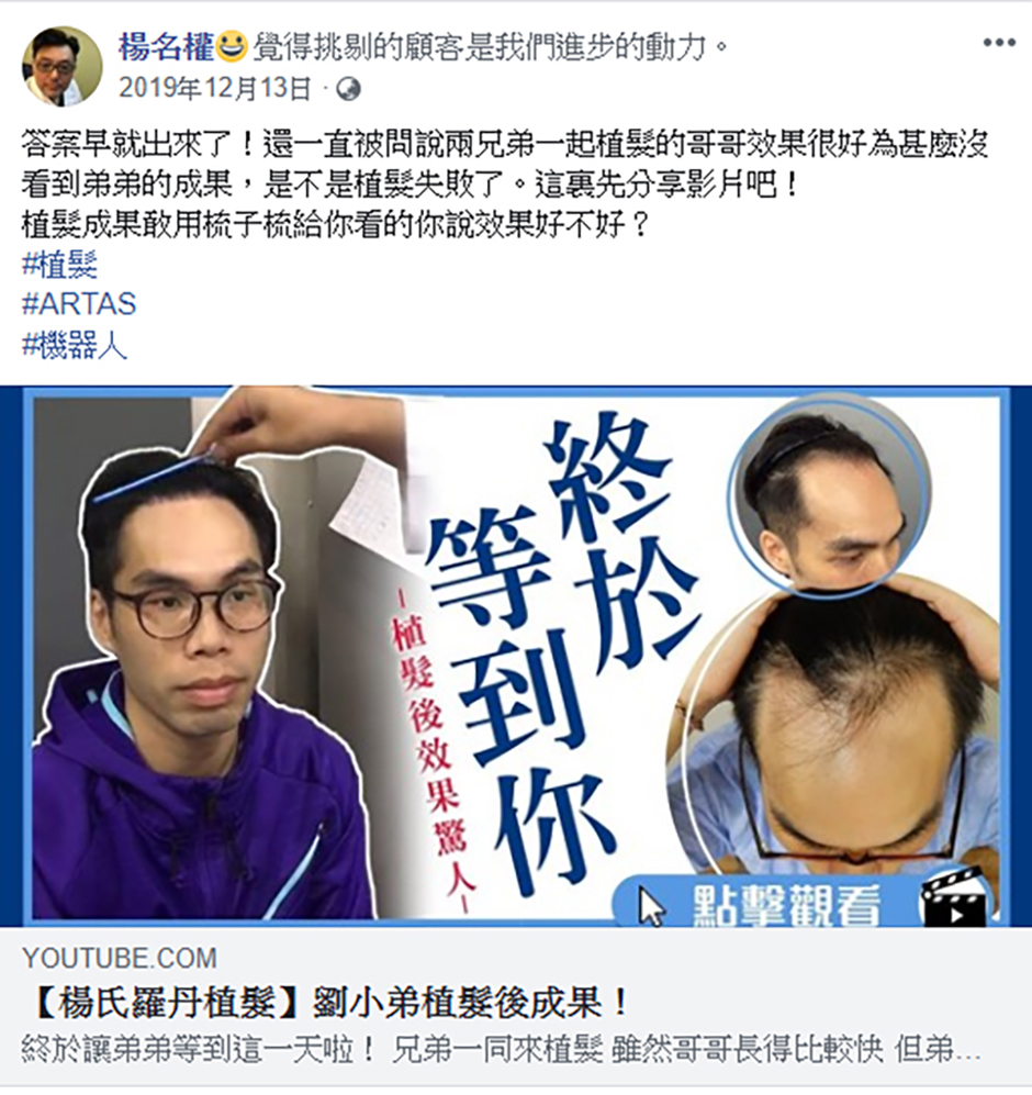 禿髮,植髮,生髮613,楊名權,楊氏羅丹